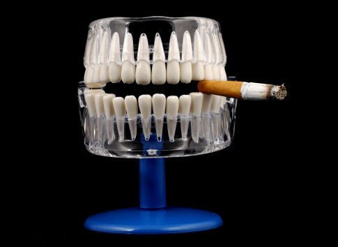 smoking and teeth